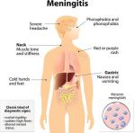 Failure to Diagnose Menin…